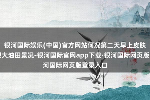 银河国际娱乐(中国)官方网站何况第二天早上皮肤不会呈现大油田景况-银河国际官网app下载·银河国际网页版登录入口